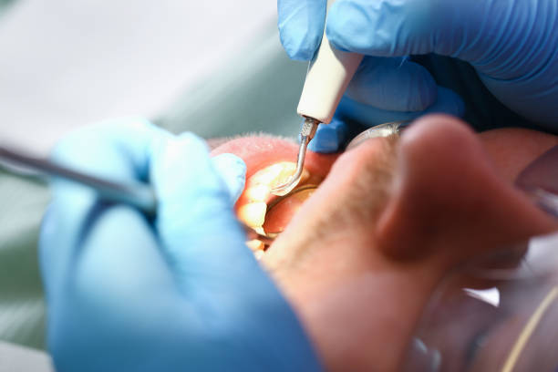 Best Emergency Root Canal Treatment in Norman Park, GA
